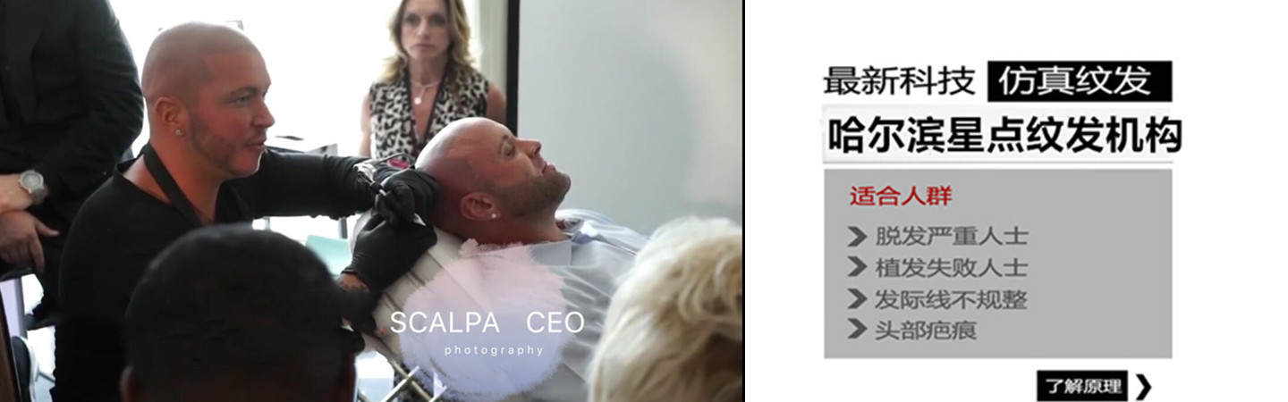 哈尔滨星点纹发